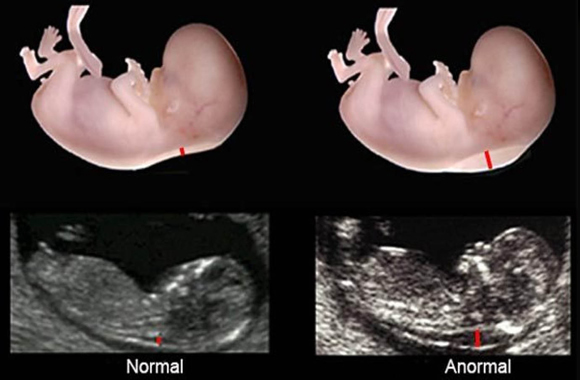 Perinat Privado SRL, ecografías generales, ecografías 5D, translucencia nucal, eco-doppler.