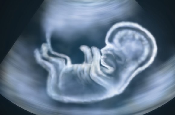 Perinat Privado SRL, ecografías generales, ecografías 5D, translucencia nucal, eco-doppler.